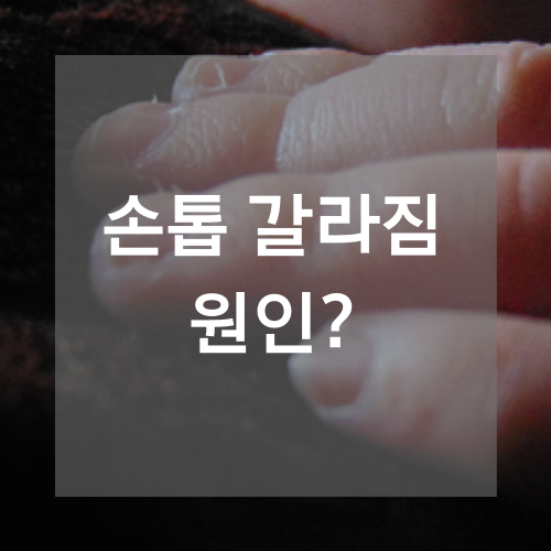 손톱 갈라짐 원인 케라셀 네일