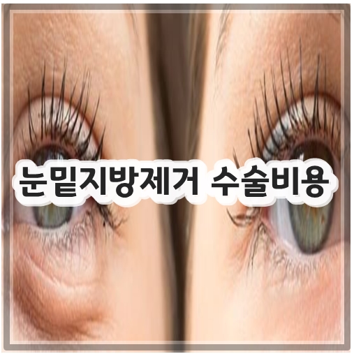 눈밑지방제거 수술비용&#44; 가격 알아보기