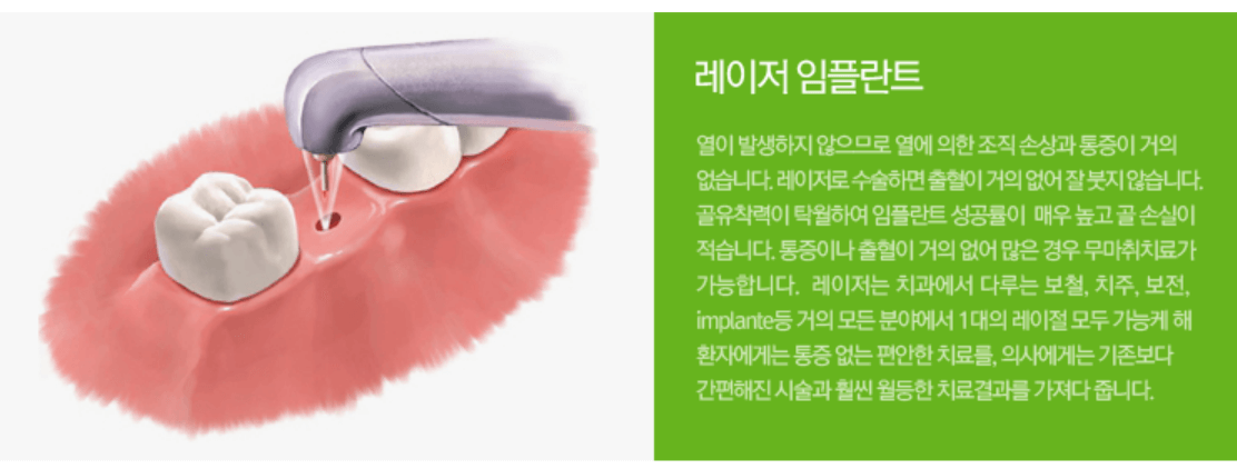 임플란트 가격 임플란트 종류 비교