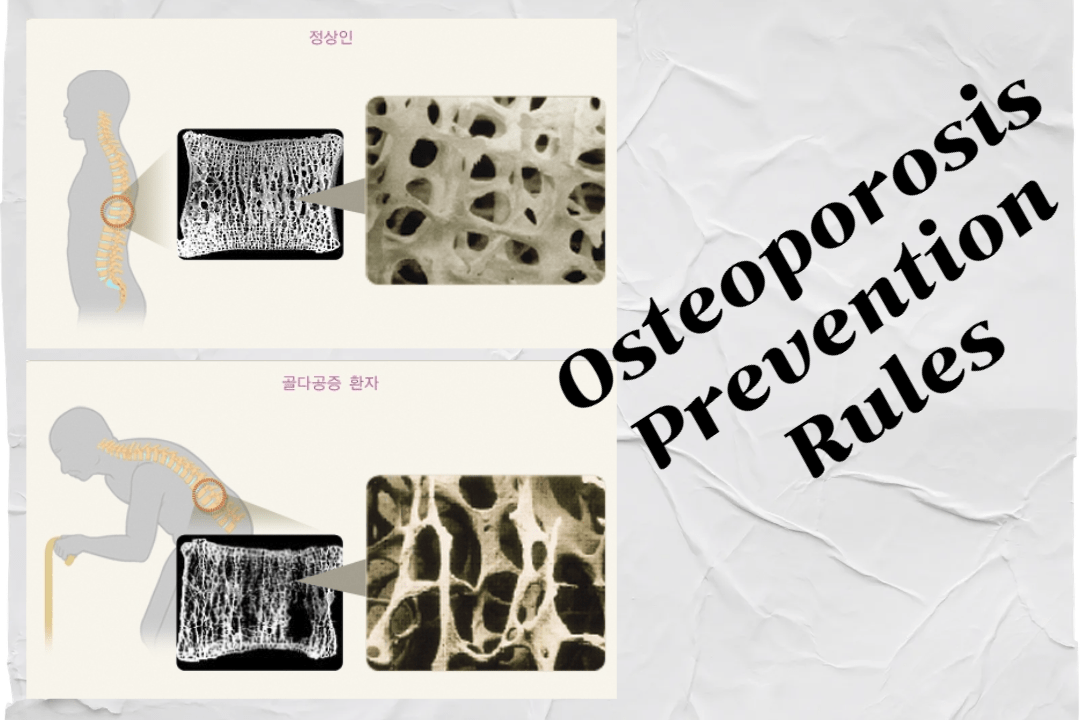 Osteoporosis Prevention Rules