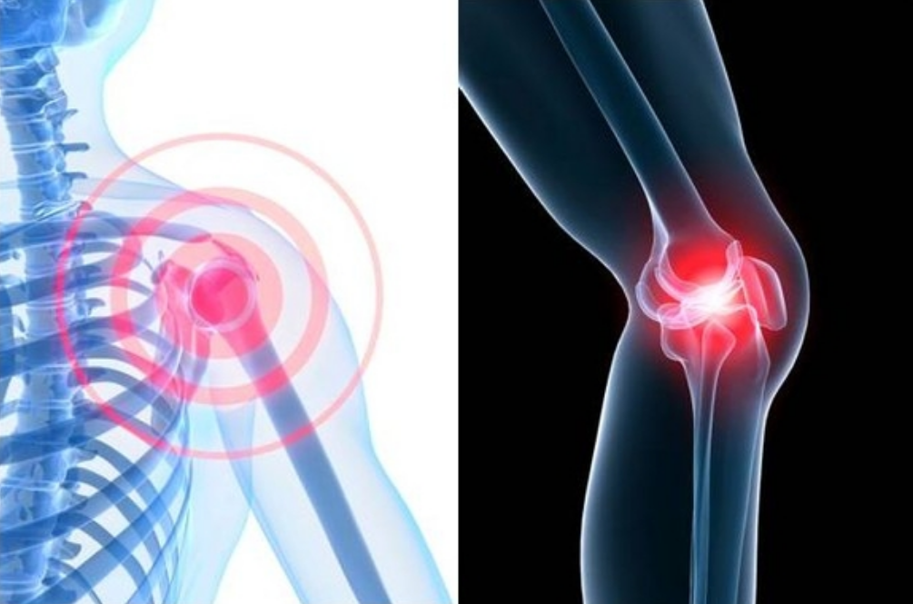 어깨와 무릎 관절에서 염증이 발생한 고령자