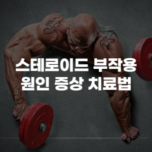 스테로이드 부작용 원인 증상 치료법