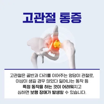 고관절 통증 증상 확인하기_21