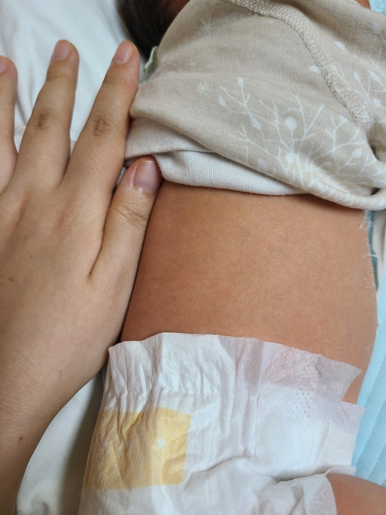 혈액형 신생아 황달 검사 / 엄마 멘탈 바사삭 5