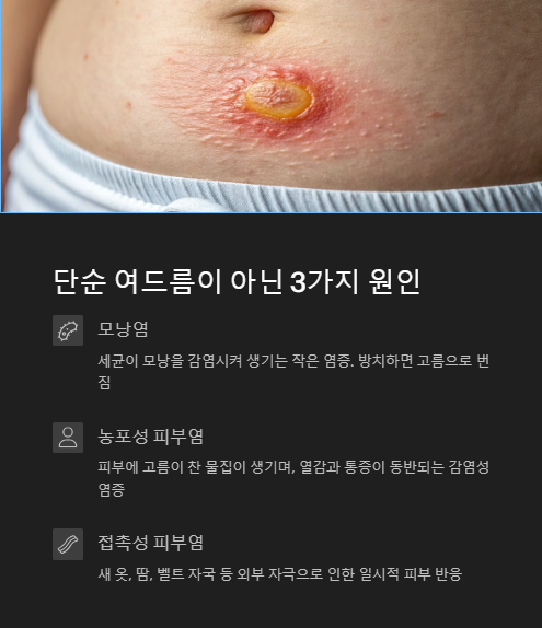 단순 여드름이 아닌 원인