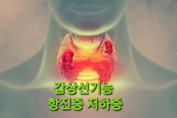 _ 요오드 섭취 갑상선 기능 항진증과 저하증