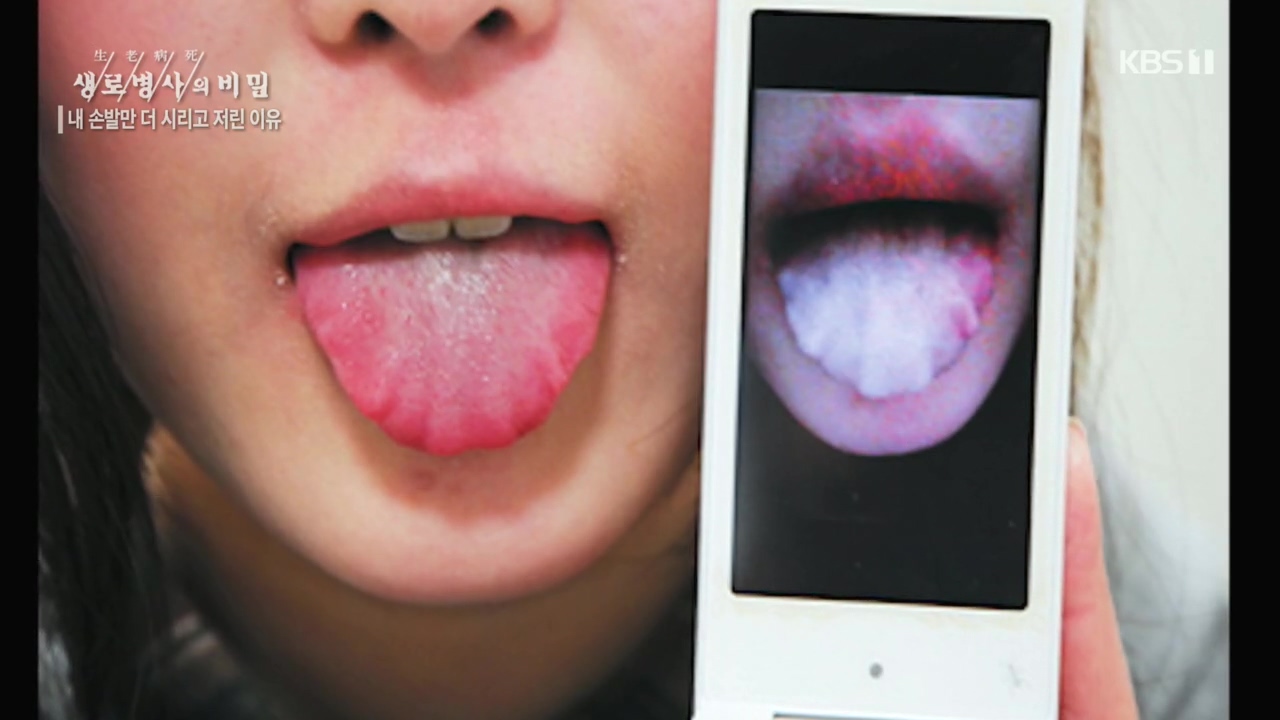 생로병사의 비밀.E847.221215p.H264-F1RST.mp4_20221215_194603.719.jpg