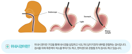 위내시경 금식시간