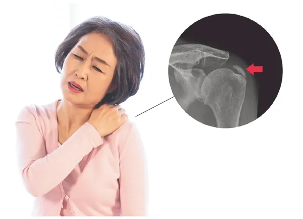 어깨랑 이미지