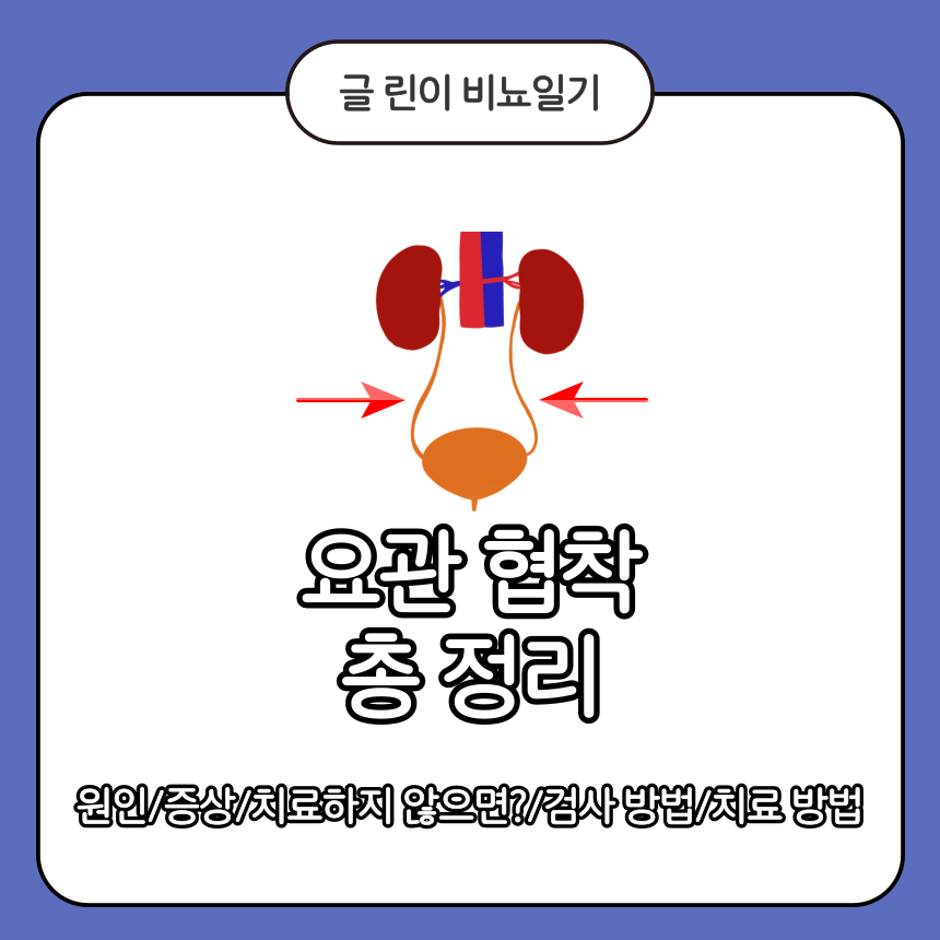  요관 협착 총 정리