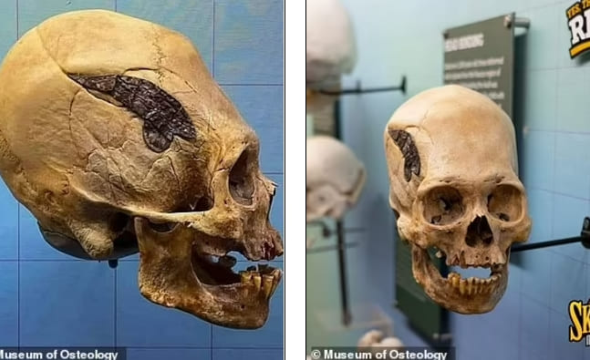 2천년 전 페루인들의 놀라운 수술 기술 VIDEO: 2,000 year-old Peruvian skull may be oldest evidence of SURGERY...