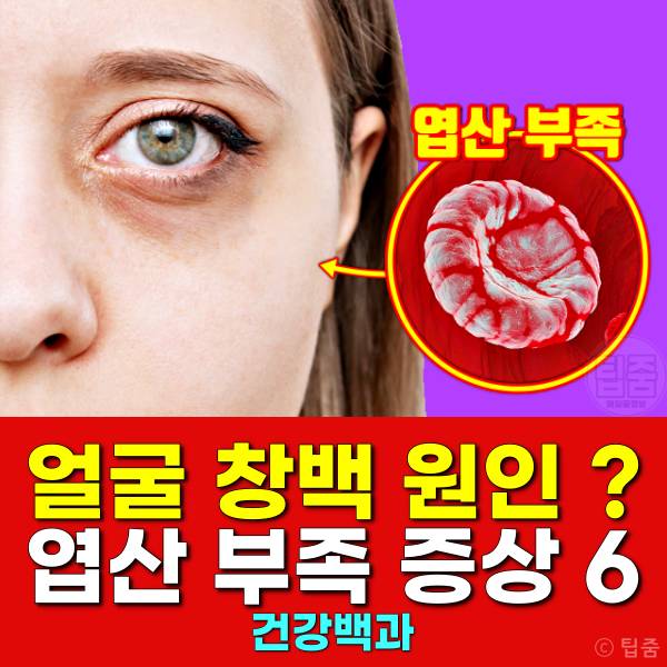 엽산 부족 증상 엽산효능 얼굴창백 원인