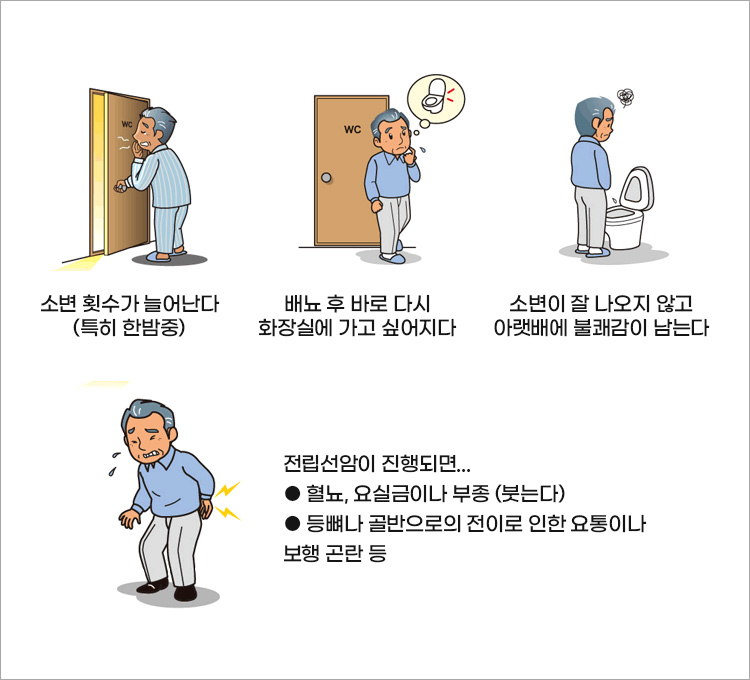 전립선암이나-전립성-비대증에서는-배뇨-장애가-흔하게-발견된다-잦은-소변-횟수-소변이-잘-나오지-않는다