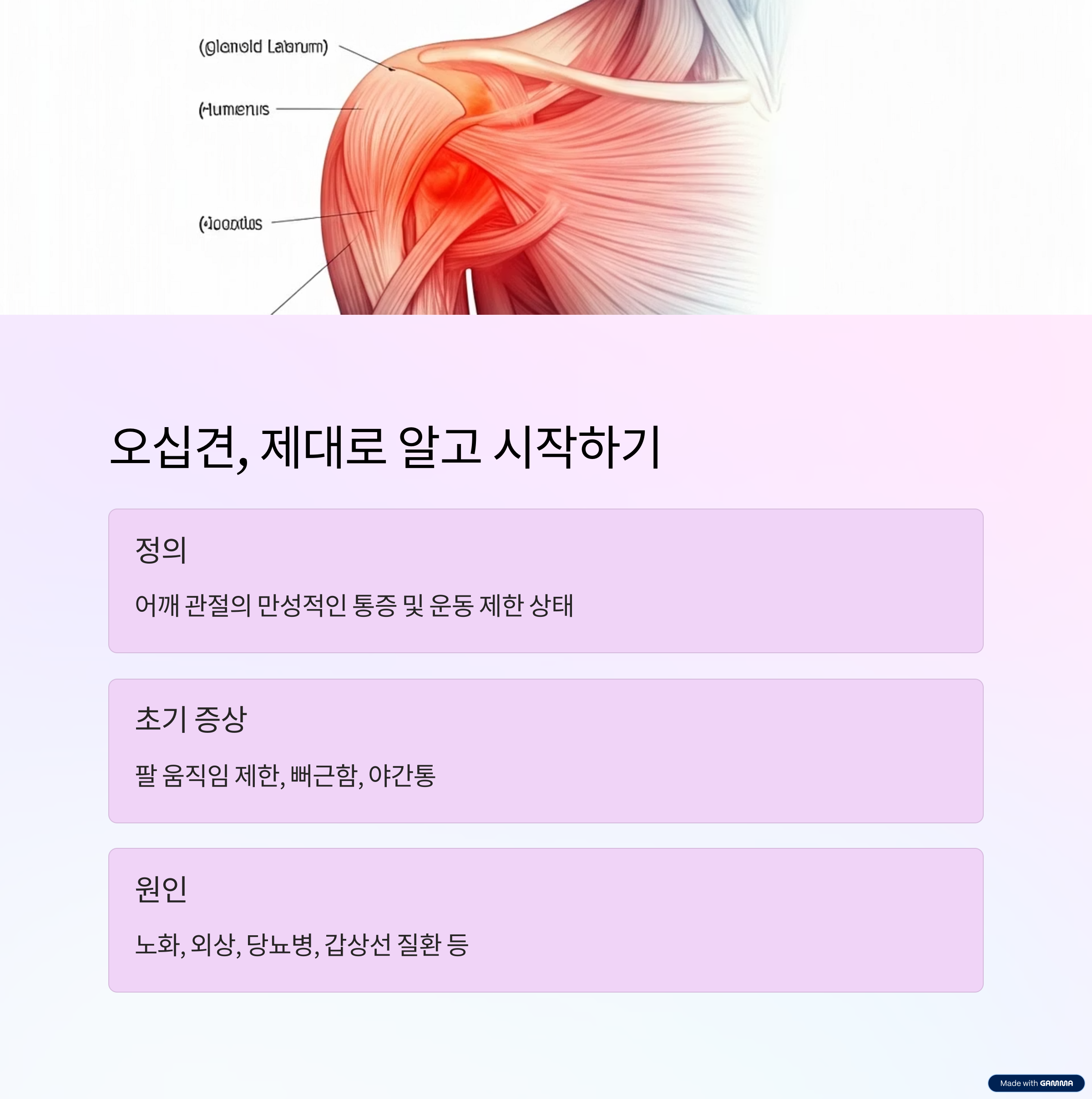 염증이 강조된 동결견관절의 의학적 그림
