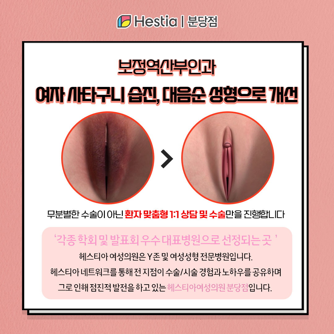여자 사타구니 가려움 여자 사타구니 습진 보정역산부인과 여자 사타구니 습진 대음순 성형으로 개선되나요?