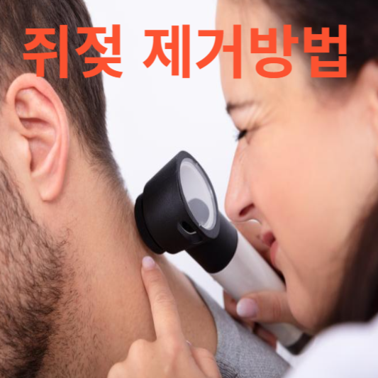 쥐젖 제거방법