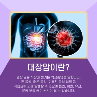 대장암이란 진료 치료 초기증상