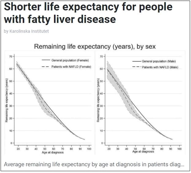  지방간 보유자, 3년 수명 짧아져 ㅣ 지방간 대책  Shorter life expectancy for people with fatty liver disease