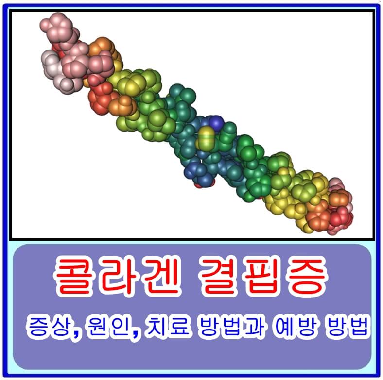  콜라겐 결핍증의 증상, 원인, 치료 방법과 예방 방법