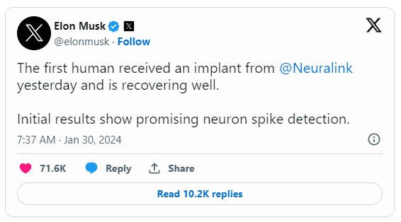  일론 머스크, 뉴럴링크(Neuralink)의 뇌 칩.. 인간에게 이식