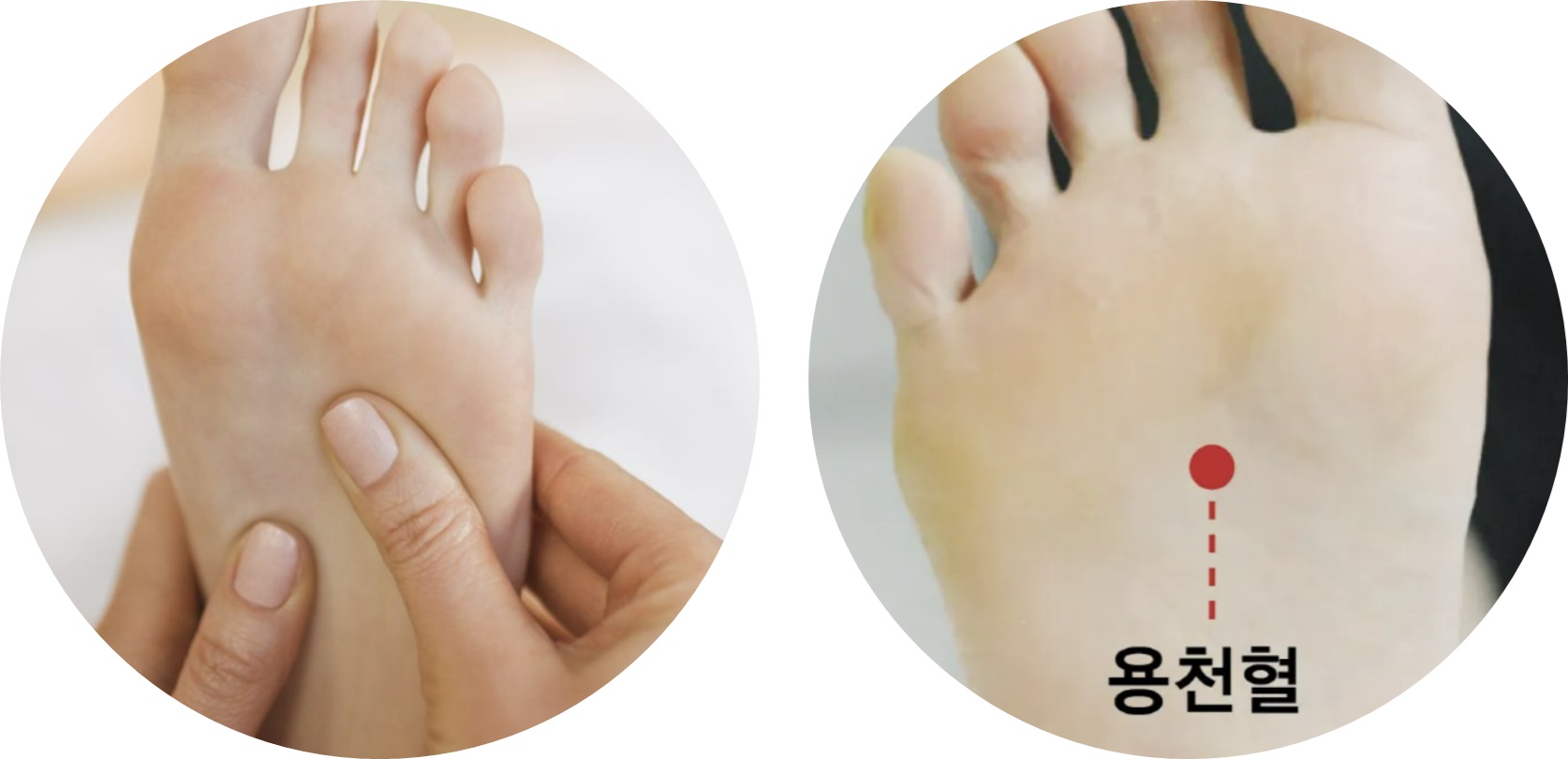 체했을때 지압 손지압 발지압 증상 음식 손따기 약 자세