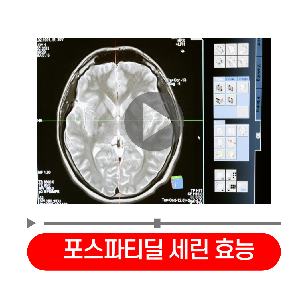 포스파티딜_세린_효능