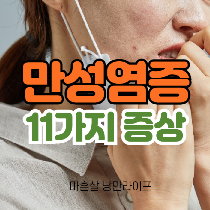 섬네일