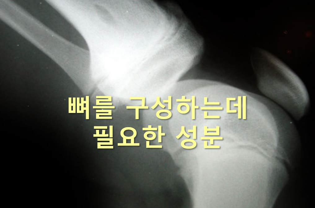  골다공증 예방에 좋은 음식과 뼈를 구성하는데 필요한 성분