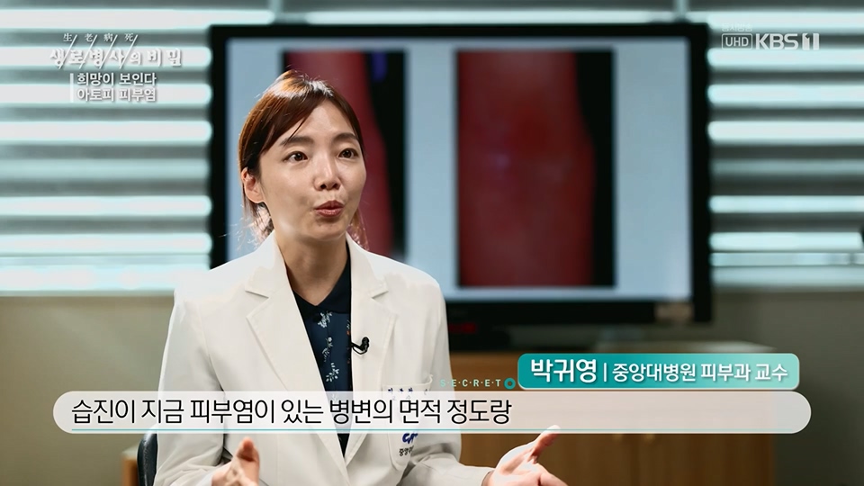 생로병사의 비밀.E872.230628p.H264-F1RST.mp4_20230707_214228.272.jpg