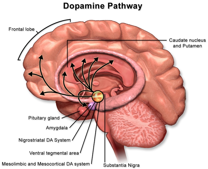 도파민 과다분비