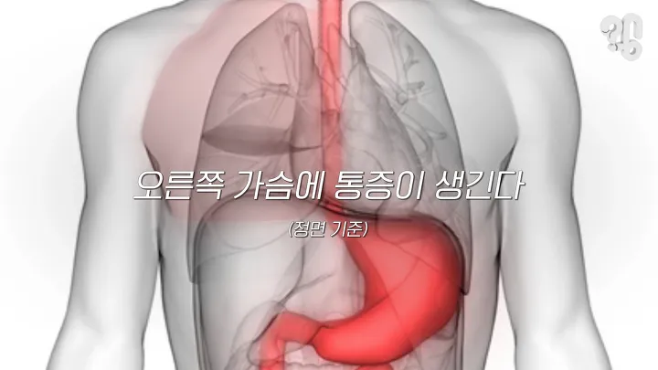 오른쪽 가슴 통증