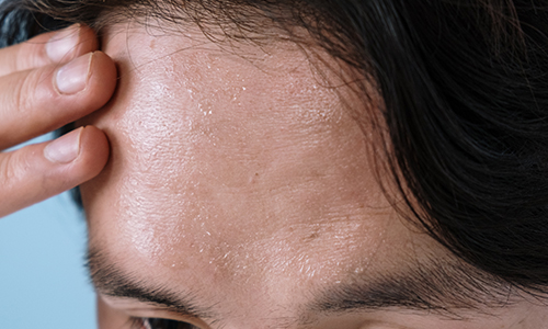 땀을 흘리다 ,  오한은 폐경기의 가장 흔한 증상 중 하나입니다.