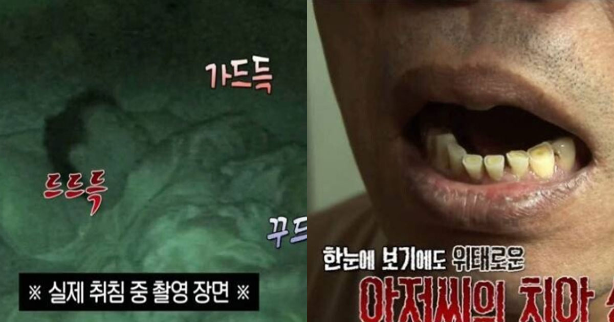  잠버릇으로 '이갈이'한다면 반드시 병원가야 하는 이유