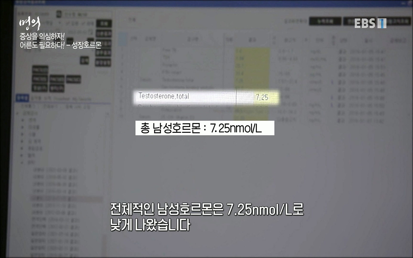EBS 명의 헬스케어 - TV - 교육의 중심 EBS내 몸을 지배하는 7가지 호르몬 2부, 증상을 의심하자!.mp4_20220711_200201.323.jpg