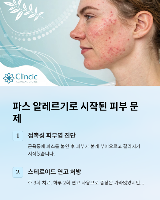 파스 알레르기로 시작된 피부 문제