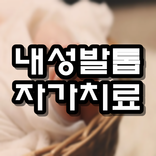  내성발톱 자가치료