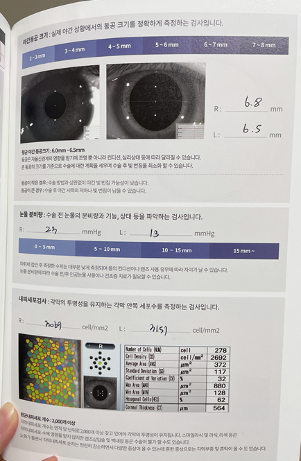 스마일라식 후기 (수술계기/병원/검안/상담/수술/후기) 스마일라식 후기 (수술계기/병원/검안/상담/수술/후기)