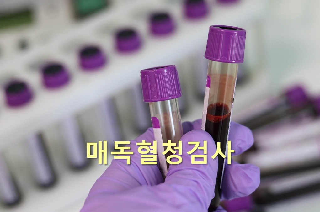  트레포네마균 감염을 진단하는 매독혈청검사