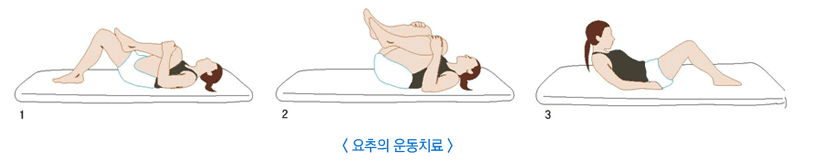 허리디스크 증세