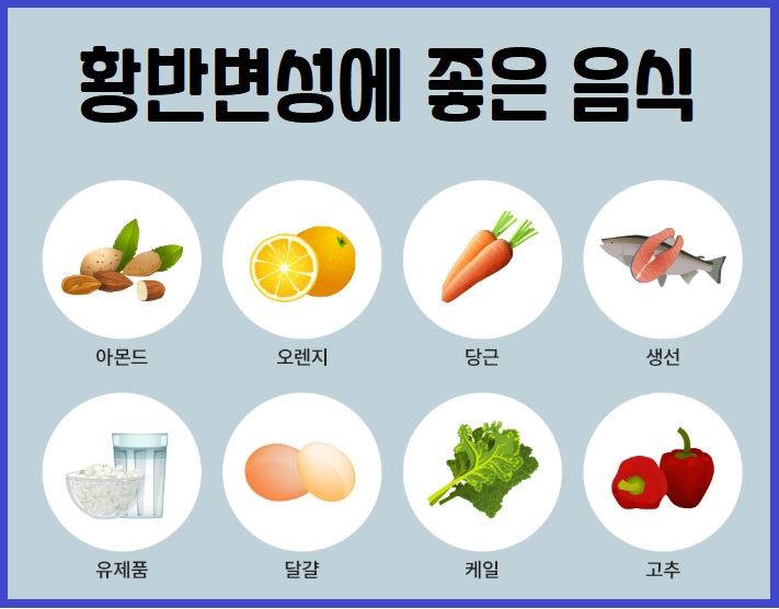 황반변성에 좋은 음식
