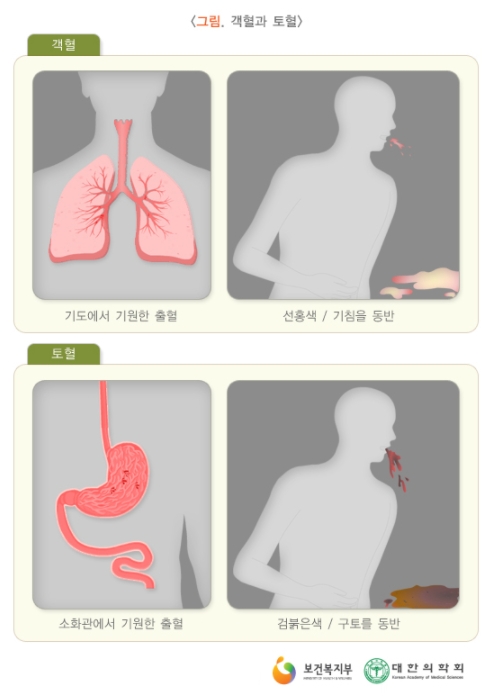 각혈