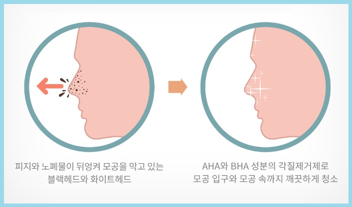 아쿠아필 효과