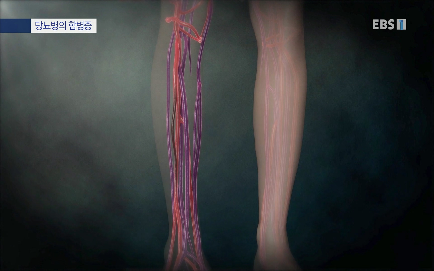 EBS 명의 헬스케어 - TV - 교육의 중심 EBS내 몸을 지배하는 7가지 호르몬 3부, 운동이 밥이다! .mp4_20220711_202513.976.jpg