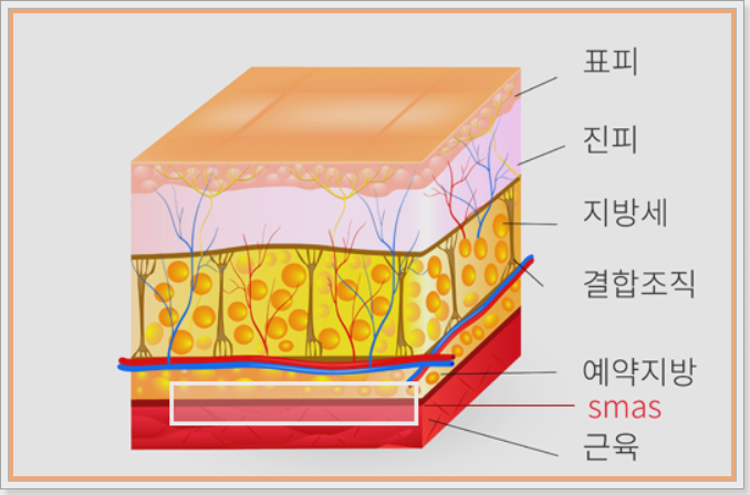 미니 리프팅 가격과 장점