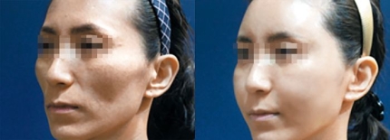 부자인력산업 이미지
