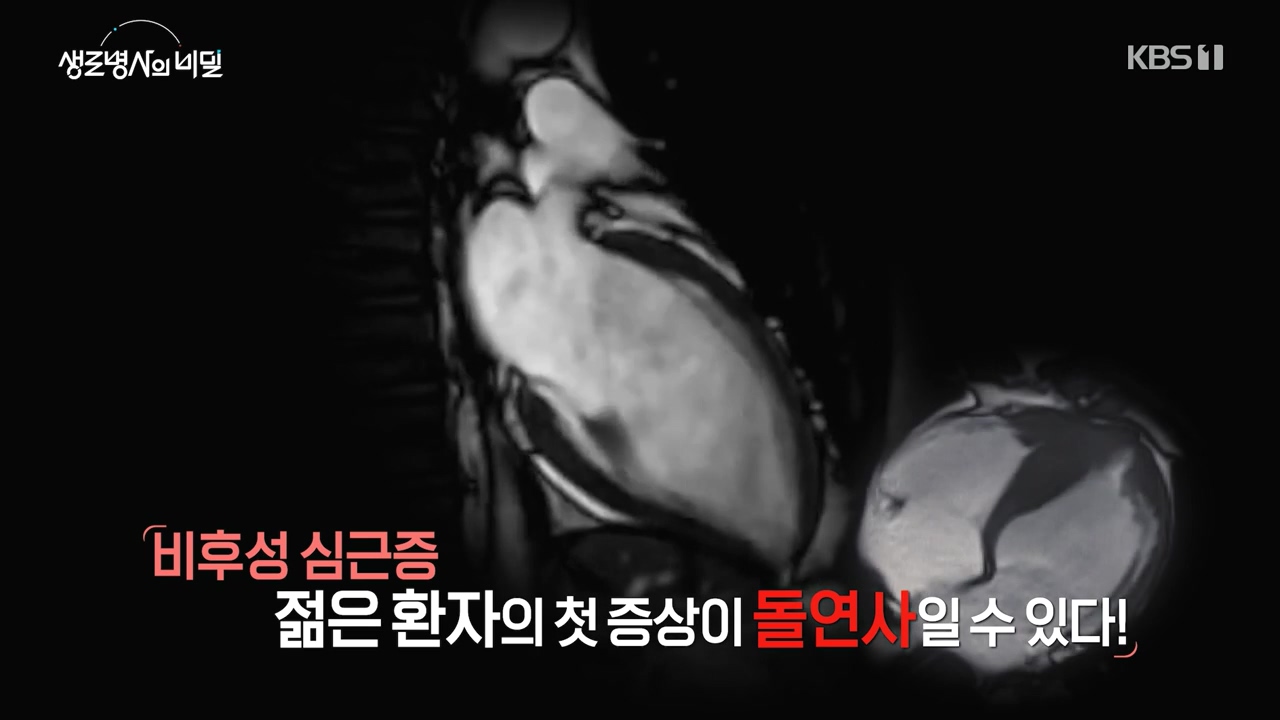 생로병사의 비밀.E912.240523p-NEXT.mp4_20240523_195830.407.jpg