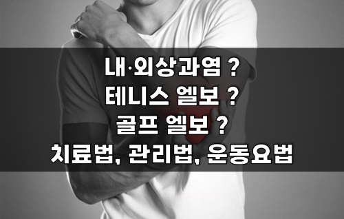  내상과염•외상과염•골프 엘보•테니스 엘보 (치료법, 관리법, 운동요법)