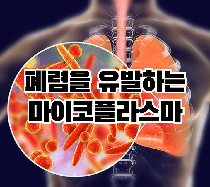 마이코플라즈마-마이코플라스마-미코플라즈마-미코플라스마-폐렴-백신-치료법-감염-세균