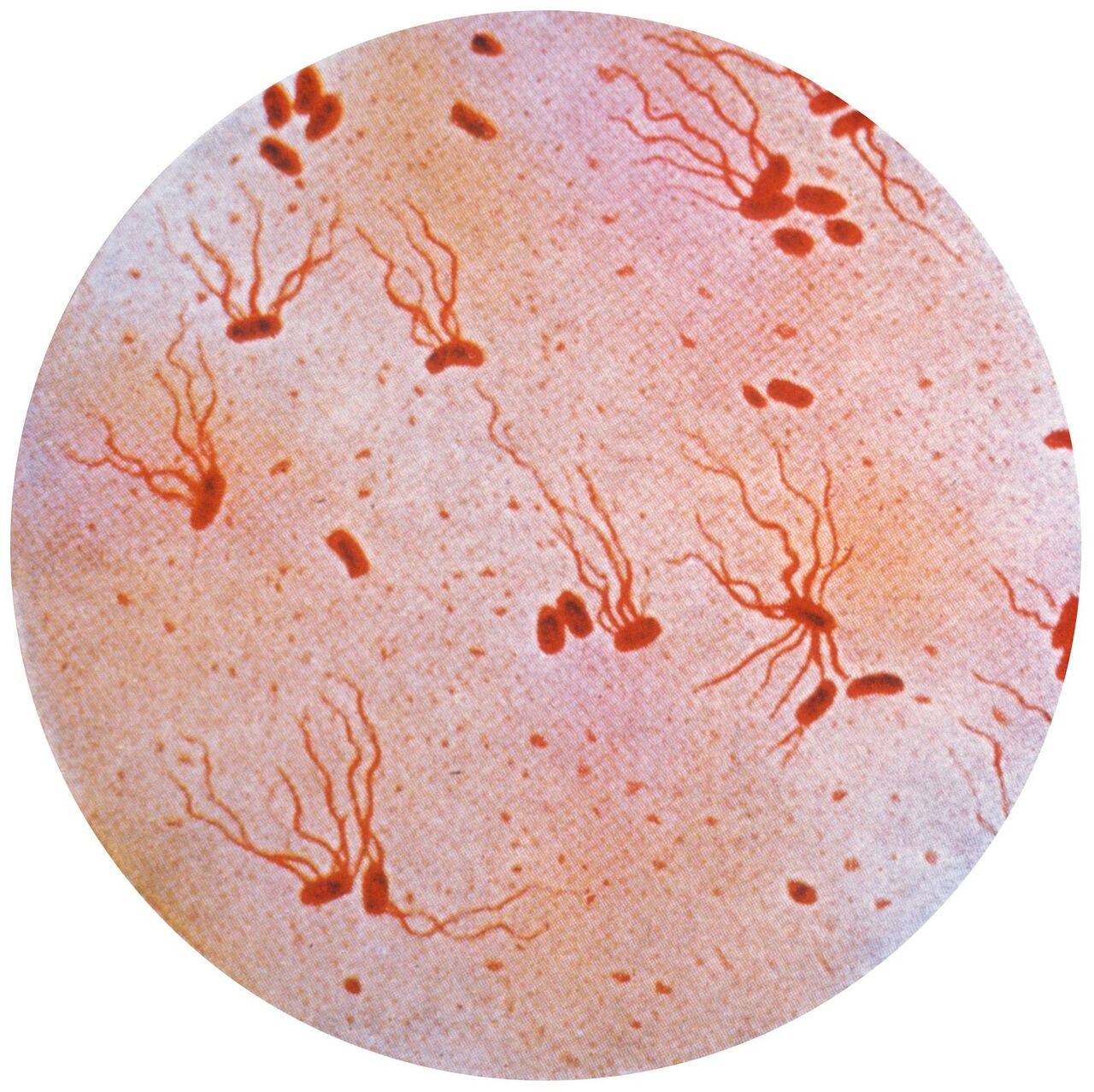  Typhoid Fever - Most common waterborne disease feat. Typhoid Fever has nothing to do with Typhus