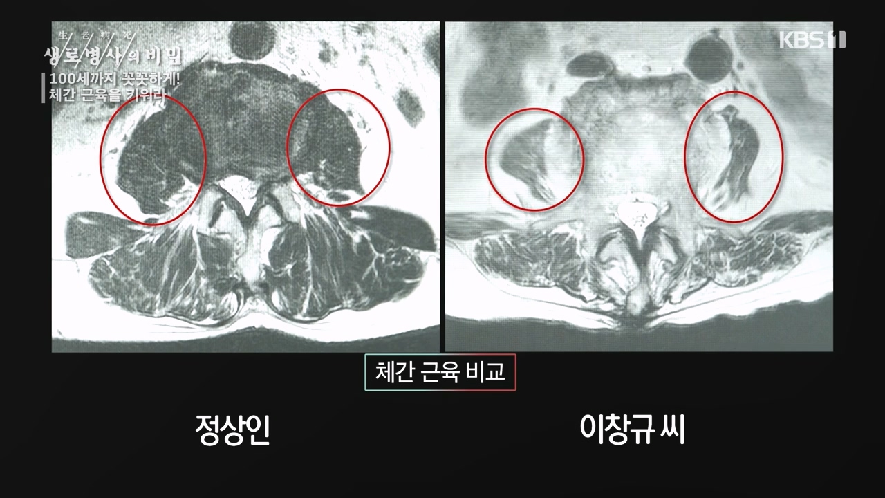 생로병사의 비밀.E885.231012p-NEXT.mp4_20231012_203440.850.jpg